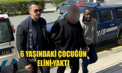 Yeğeninin elini çakmakla yaktı