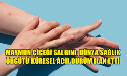 MAYMUN ÇİÇEĞİ SALGINI: DÜNYA SAĞLIK ÖRGÜTÜ KÜRESEL ACİL DURUM İLAN ETTİ