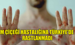 TÜRKİYE SAĞLIK BAKANLIĞI, M ÇİÇEĞİ HASTALIĞINA TÜRKİYE'DE RASTLANMADIĞINI DUYURDU