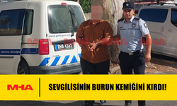 SEVGİLİSİNİN BURUN KEMİĞİNİ KIRDI!