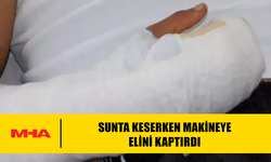 SUNTA KESERKEN MAKİNEYE ELİNİ KAPTIRDI