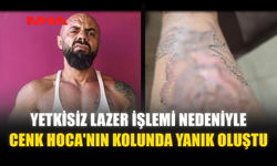 YETKİSİZ LAZER İŞLEMİ NEDENİYLE CENK HOCA'NIN KOLUNDA YANIK OLUŞTU