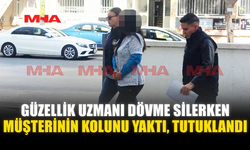 GÜZELLİK UZMANI DÖVME SİLERKEN MÜŞTERİNİN KOLUNU YAKTI‚ TUTUKLANDI