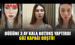 DÜĞÜNÜNE 3 AY KALA BOTOKS YAPTIRAN KADININ GÖZ KAPAĞI DÜŞTÜ