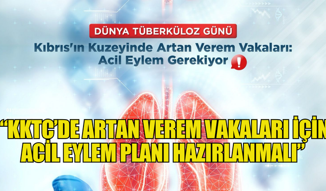 Tabipler Birliği: “KKTC’de artan verem vakaları için acil eylem planı hazırlanmalı”