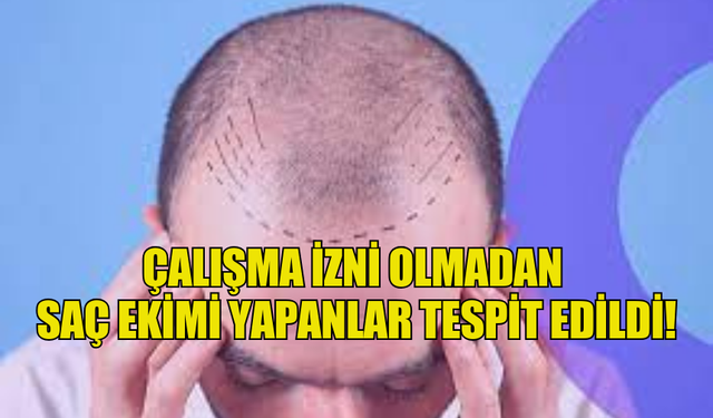 ÇALIŞMA İZNİ OLMADAN SAÇ EKİMİ YAPANLAR TESPİT EDİLDİ!