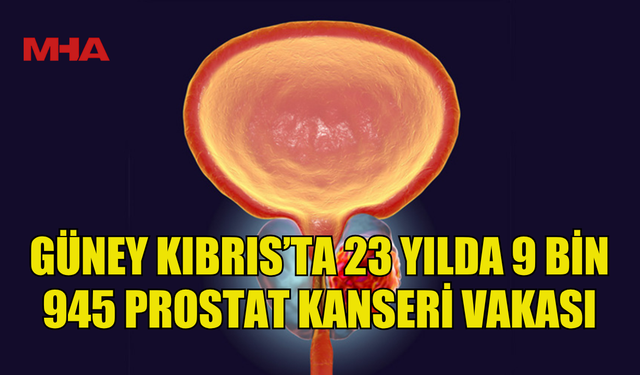 GÜNEY KIBRIS’TA 23 YILDA 9 BİN 945 PROSTAT KANSERİ VAKASI