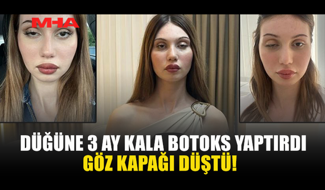 DÜĞÜNÜNE 3 AY KALA BOTOKS YAPTIRAN KADININ GÖZ KAPAĞI DÜŞTÜ