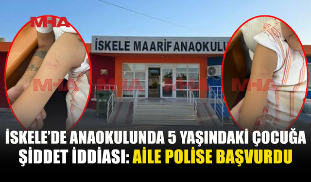 İSKELE’DE ANAOKULUNDA Ş*DDET İDDİASI! AİLE POLİSE BAŞVURDU