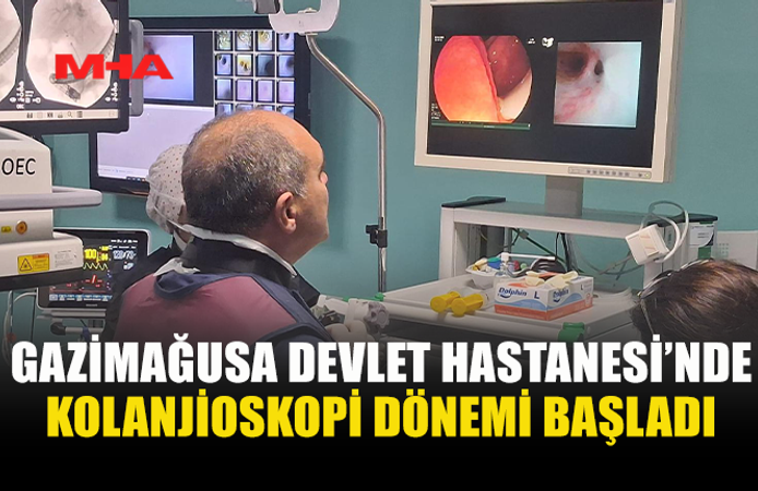GAZİMAĞUSA DEVLET HASTANESİ’NDE KOLANJİOSKOPİ HİZMETE GİRDİ