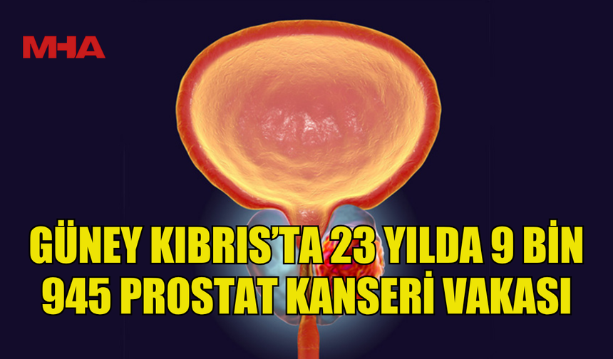 GÜNEY KIBRIS’TA 23 YILDA 9 BİN 945 PROSTAT KANSERİ VAKASI