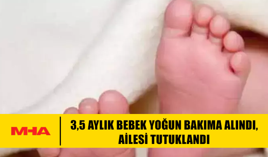3,5 AYLIK BEBEK YOĞUN BAKIMA ALINDI, AİLESİ TUTUKLANDI