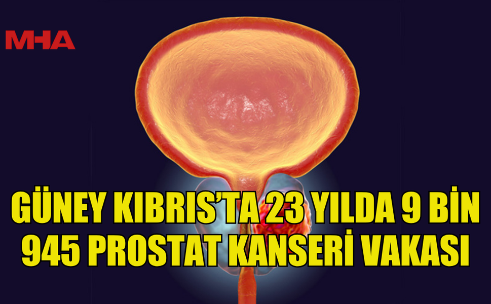 GÜNEY KIBRIS’TA 23 YILDA 9 BİN 945 PROSTAT KANSERİ VAKASI
