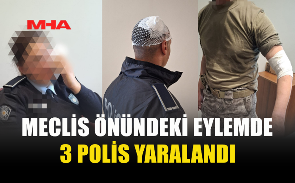 POLİS GENEL MÜDÜRLÜĞÜ: “EYLEMDE YARALANAN 3 POLİSİMİZİN TEDAVİSİ YAPILMIŞTIR”