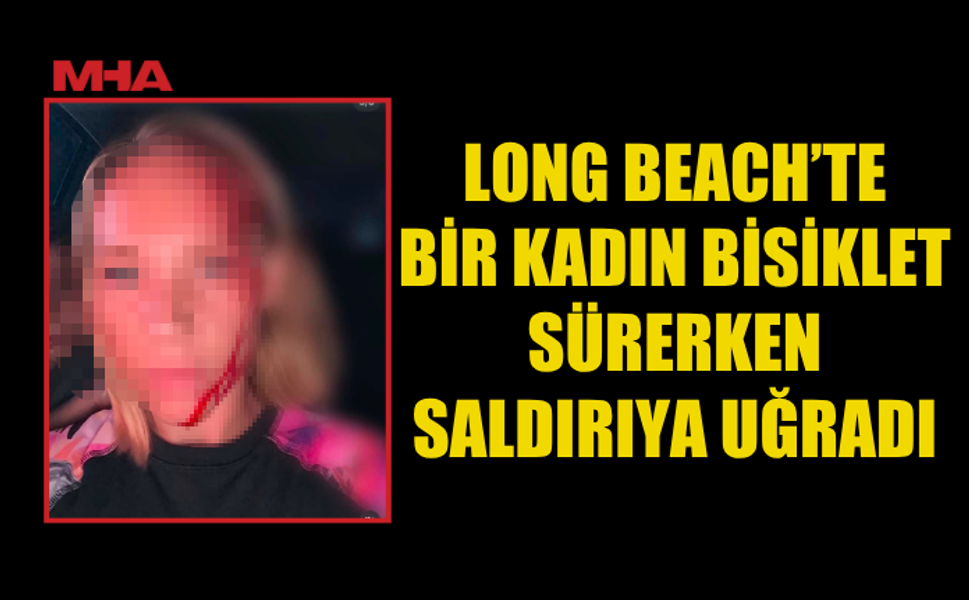 ÇOCUĞUNUN GÖZÜ ÖNÜNDE SALDIRIYA UĞRADI