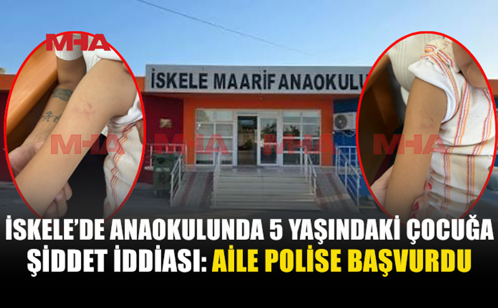 İSKELE’DE ANAOKULUNDA Ş*DDET İDDİASI! AİLE POLİSE BAŞVURDU